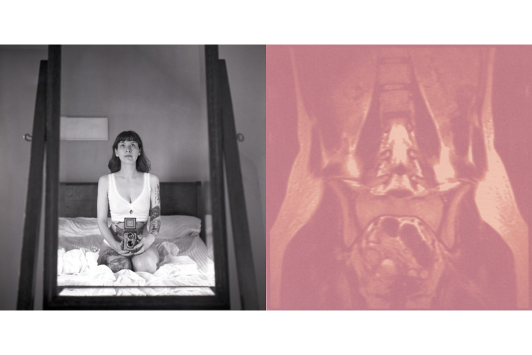 Picture of a woman, Sarah Eckstine, on the left taking a picture of herself in the mirror sitting on her bed. The left has a pink toned MRI of the artists midsection.